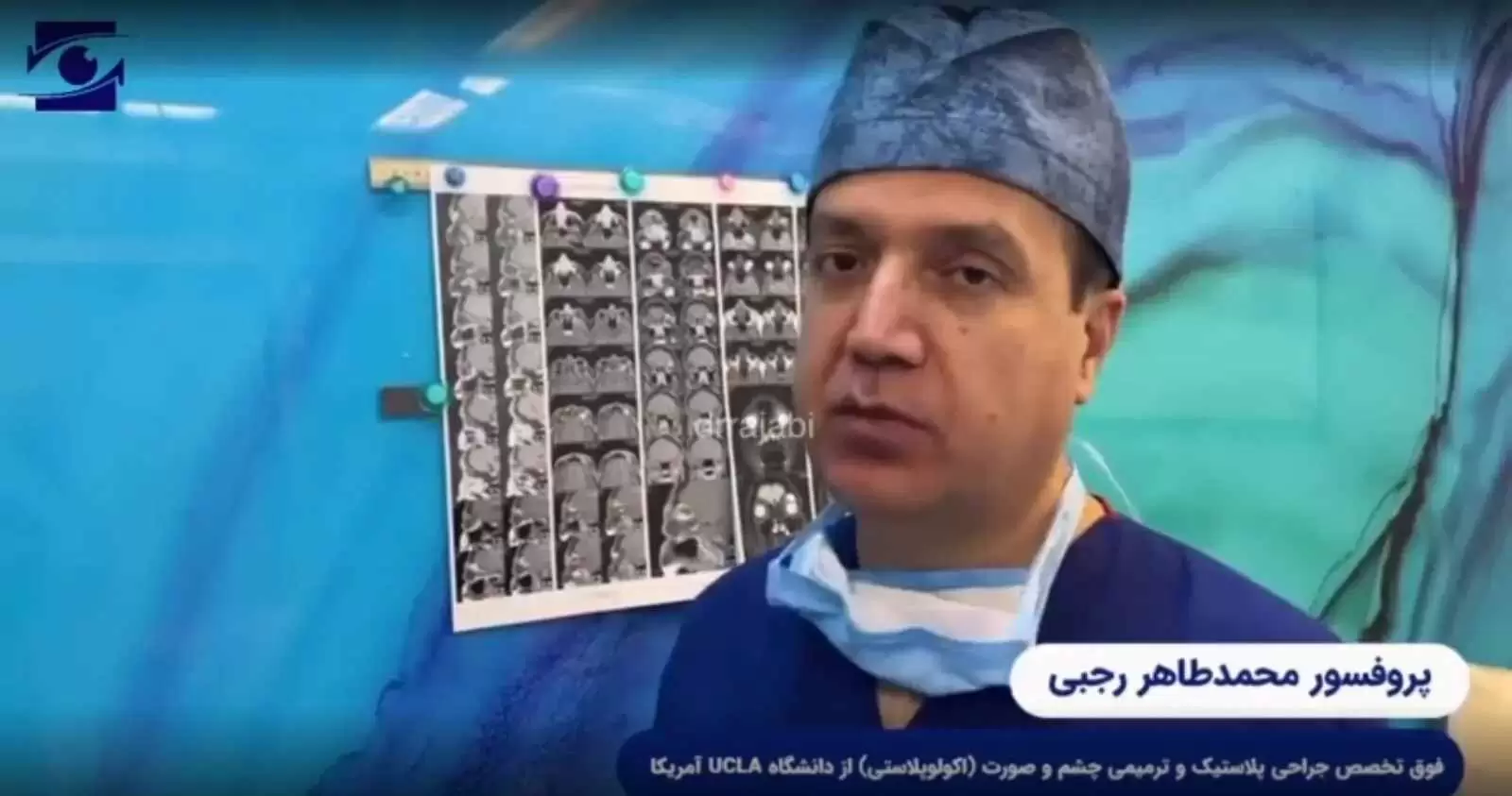ویدئو: جراحی تومور شوانوم سوپرااربیتال